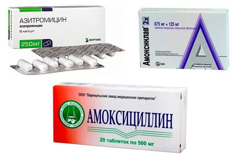 Противовирусные препараты в нос: аналоги лекарств при простуде, противовоспалительное и иммуномодулирующее средство для взрослых и детей