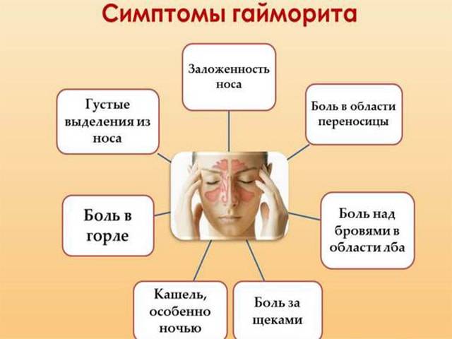 Аллергический гайморит: симптомы и лечение у взрослых