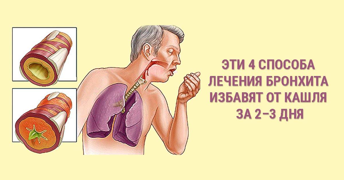 Как вылечить астму народными средствами в домашних условиях