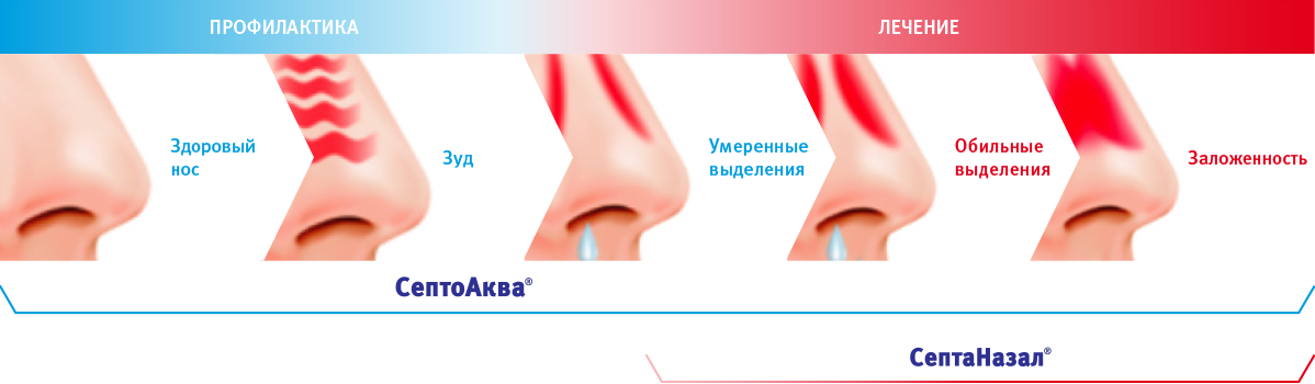 Заложенность носа у ребёнка: лечение в домашних условиях pulmono.ru
заложенность носа у ребёнка: лечение в домашних условиях