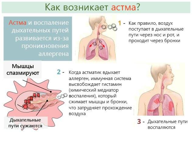 Как начинается бронхиальная астма у детей: признаки, симптомы и лечение