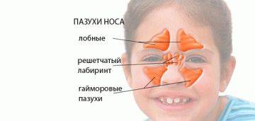 Лечение острого синусита у ребенка. советы родителям.