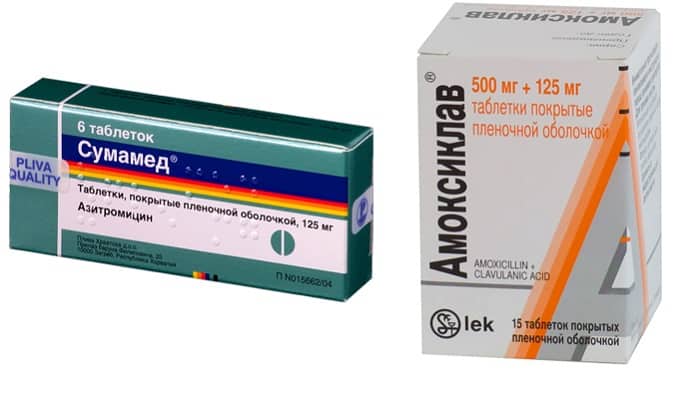 Антибиотики при трахеите: лечение, какие препараты принимать