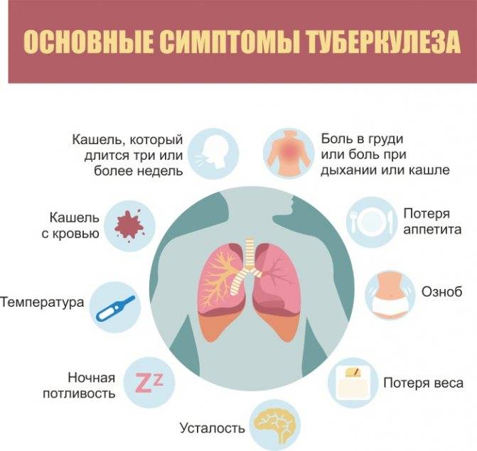 Признаки туберкулеза у детей и первые симптомы