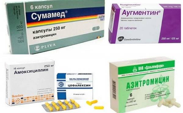 Чем лечить кишечную инфекцию у взрослых: лекарства и противовирусные препараты