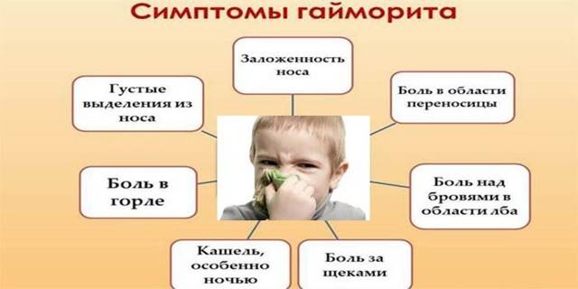 Симптомы и лечение гайморита у детей