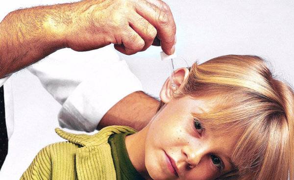 Катаральный отит у ребенка: симптомы и лечение
