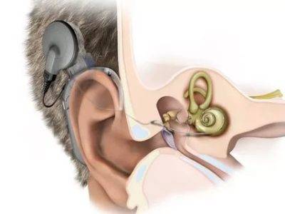 Народные средства для улучшения слуха!