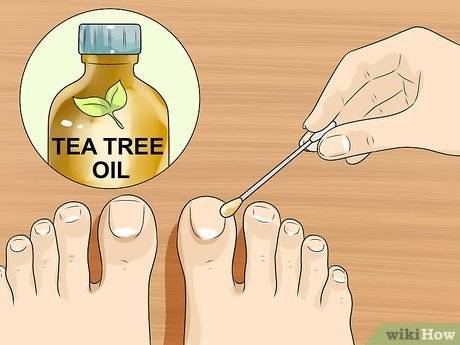 Грибок ногтей - лечение народными средствами грибка на ногах