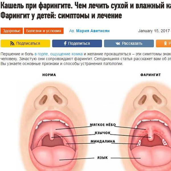 Чем лечить кашель при фарингите у взрослых и детей pulmono.ru
чем лечить кашель при фарингите у взрослых и детей