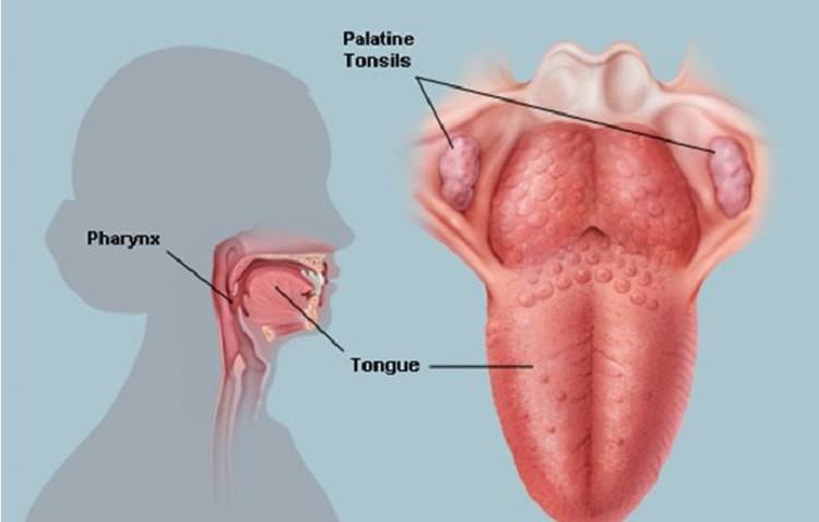 Гранулезный фарингит: фото горла у взрослого, симптомы и лечение
