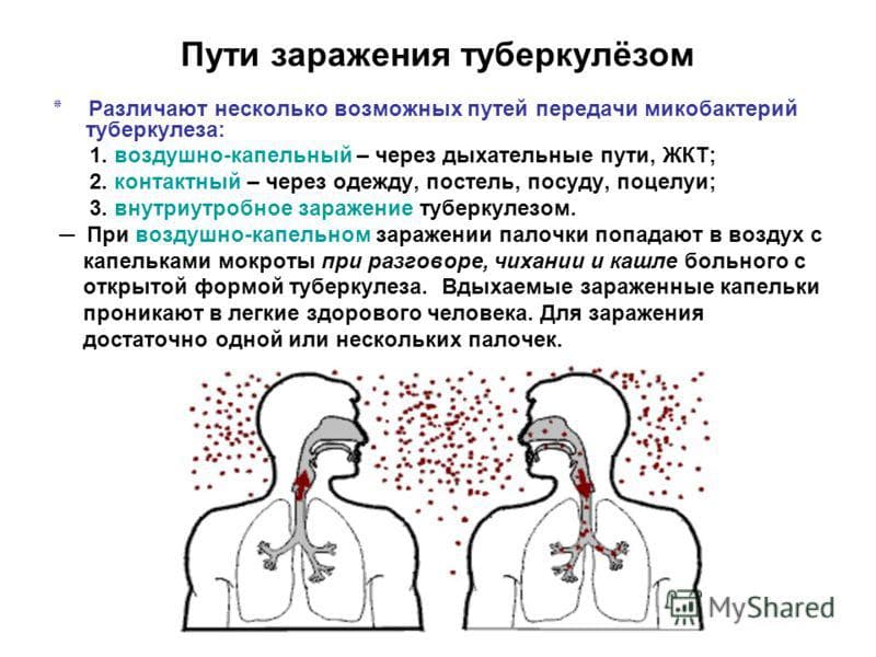 Заразен ли ларингит для окружающих и как он передается pulmono.ru
заразен ли ларингит для окружающих и как он передается