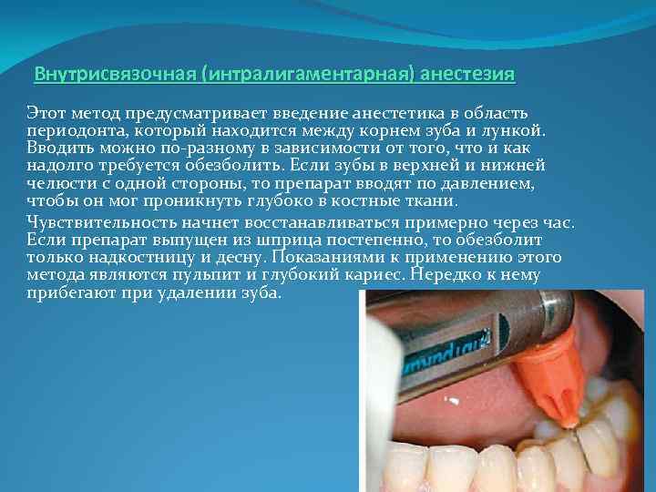 Анестезия в стоматологии, виды анестезии, противопоказания и особенности