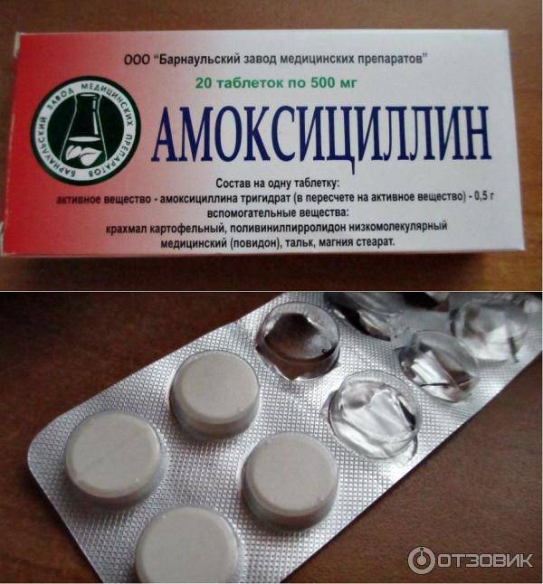 Хронический тонзиллит таблетки для рассасывания
