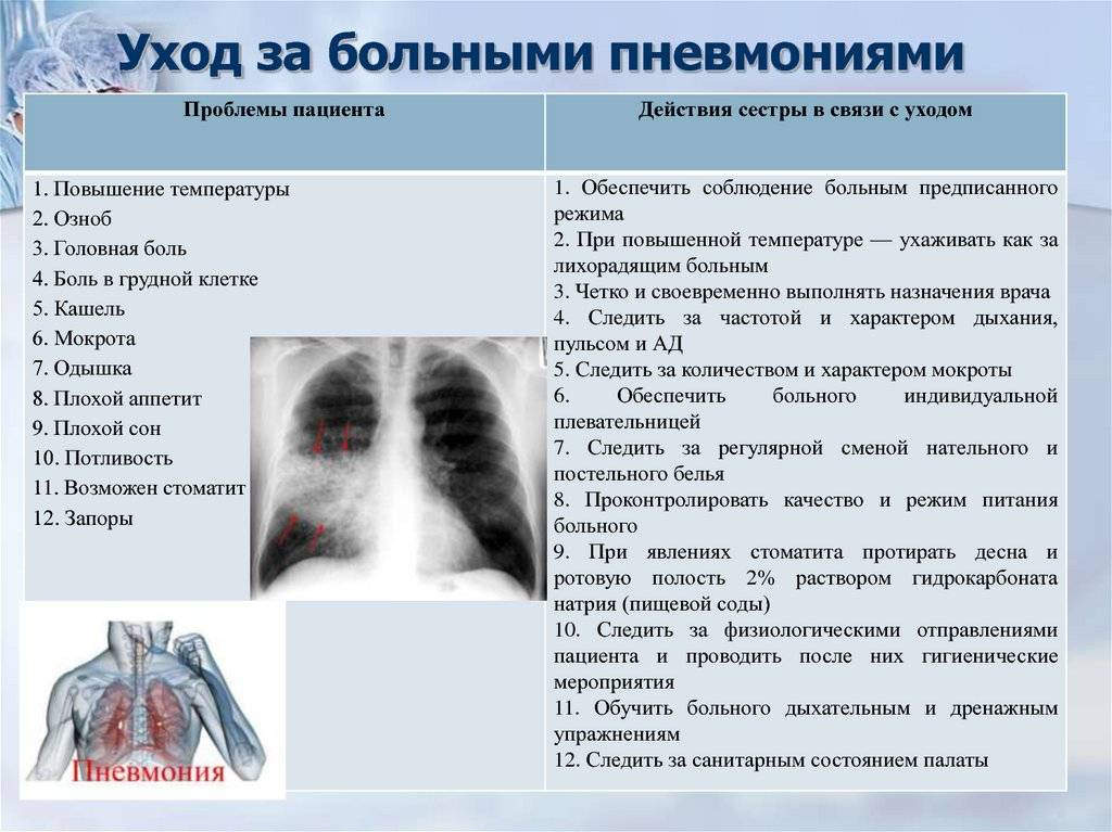 Нижнедолевая двухсторонняя пневмония – повод для госпитализации