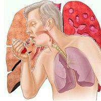 Привкус крови во рту при кашле, причины почему появляется кашель с привкусом крови во рту?
