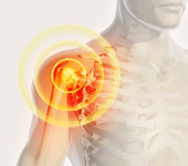 Как эффективно лечить тендинит плечевого сустава: медикаменты, физиотерапия и народные методы