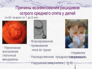 Симптомы и лечение катарального отита у детей