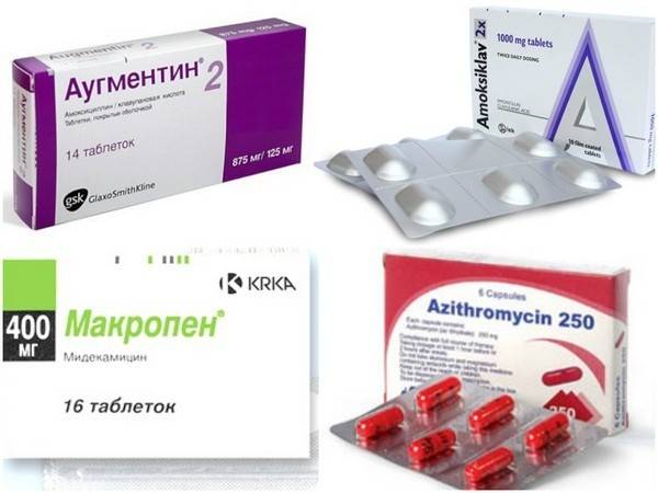Антибиотики при ангине у детей: список с названиями в сутпензии и таблетках