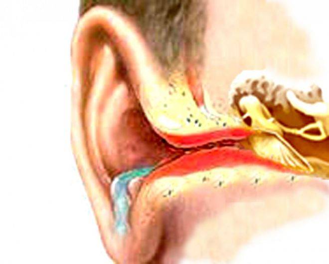 Наружный диффузный отит: симптомы и лечение, уха, как лечить