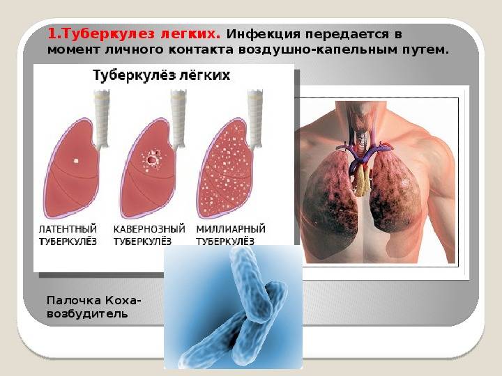 Как передается туберкулез от человека к человеку, каким путем