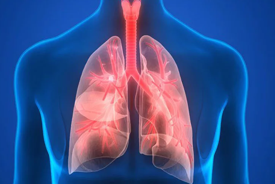 Симптомы пневмонии (воспаления лёгких) без температуры