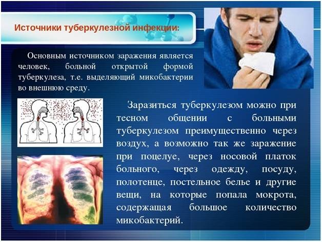 Туберкулез симптомы: 5 первых признаков туберкулеза легких у взрослых