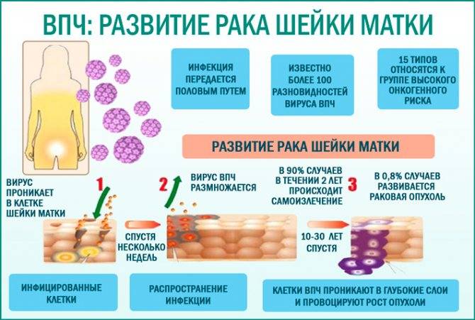 Вакцины против вируса папилломы человека. в каком возрасте делать прививку от впч