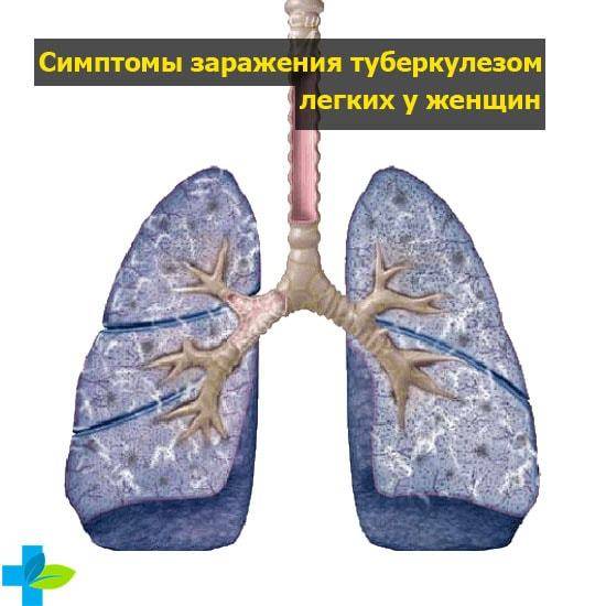 Симптомы туберкулеза легких у взрослых мужчин и женщин на ранней стадии