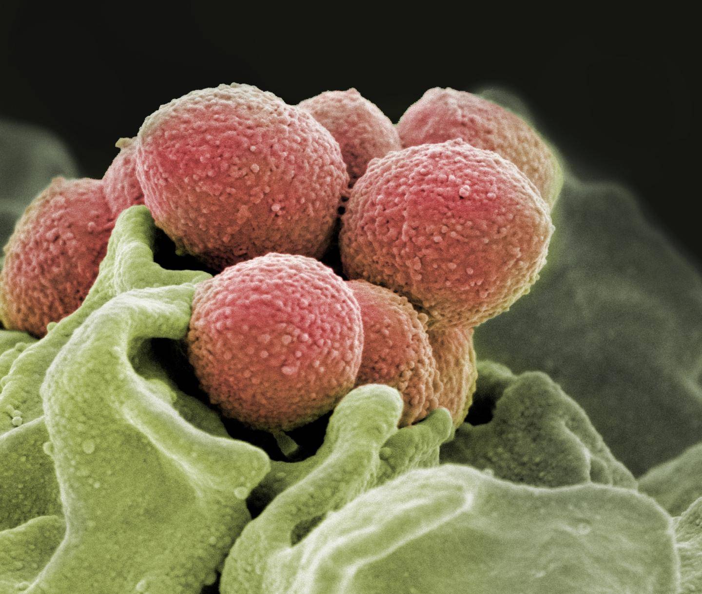 Бактерии вызывающие ангину относят к группе - грибок вирус ли это, стрептококк, микробы в горле