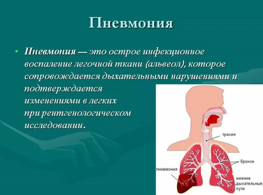 Пневмония симптомы у детей с температурой и без: методы лечения