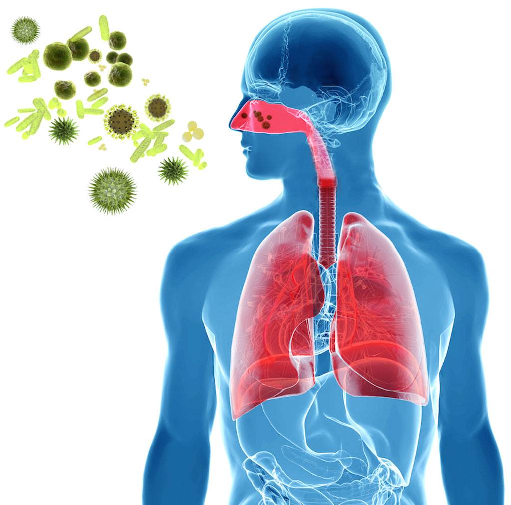Пневмония: симптомы, пути передачи, лечение