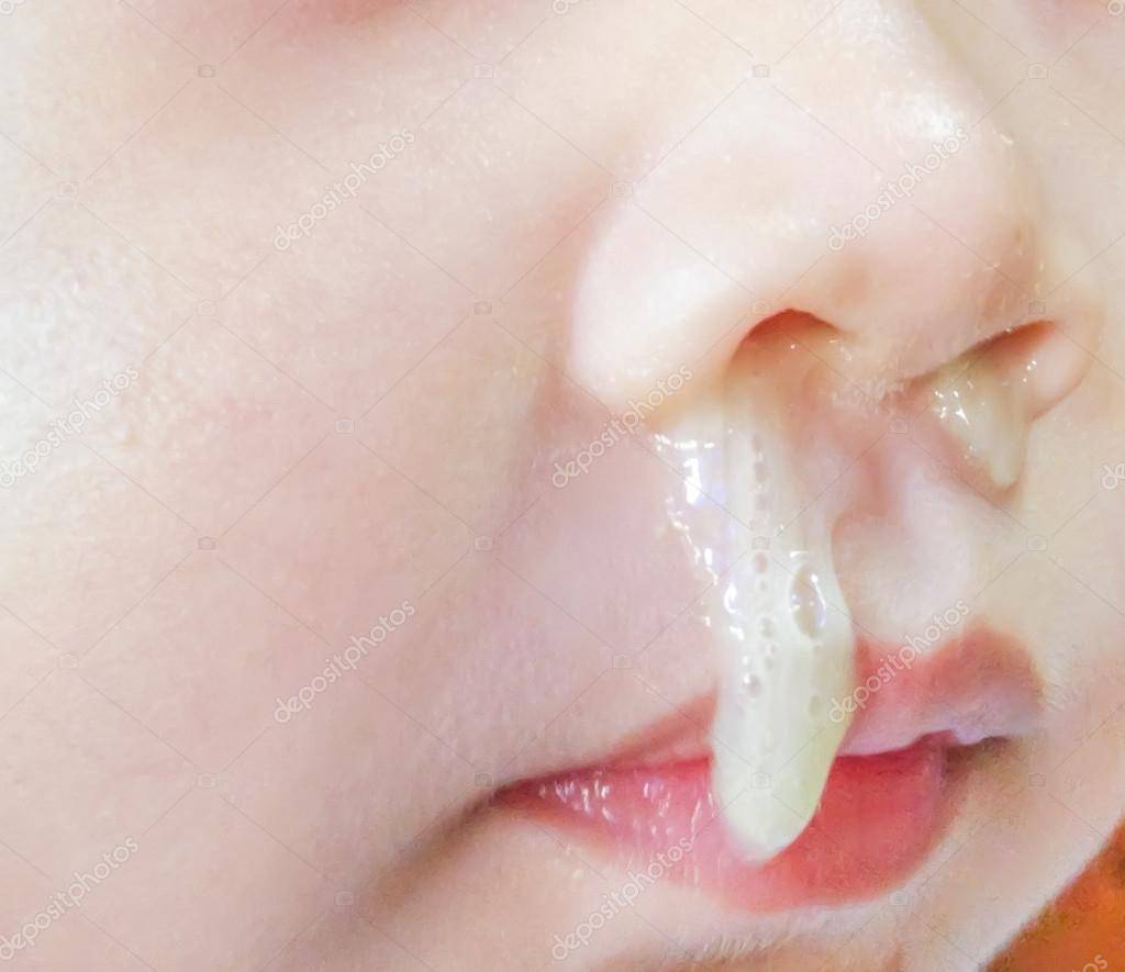Сопли как вода - лечение жидких у ребенка, как и чем лечить прозрачные если текут ручьем из носа, что делать если потекли