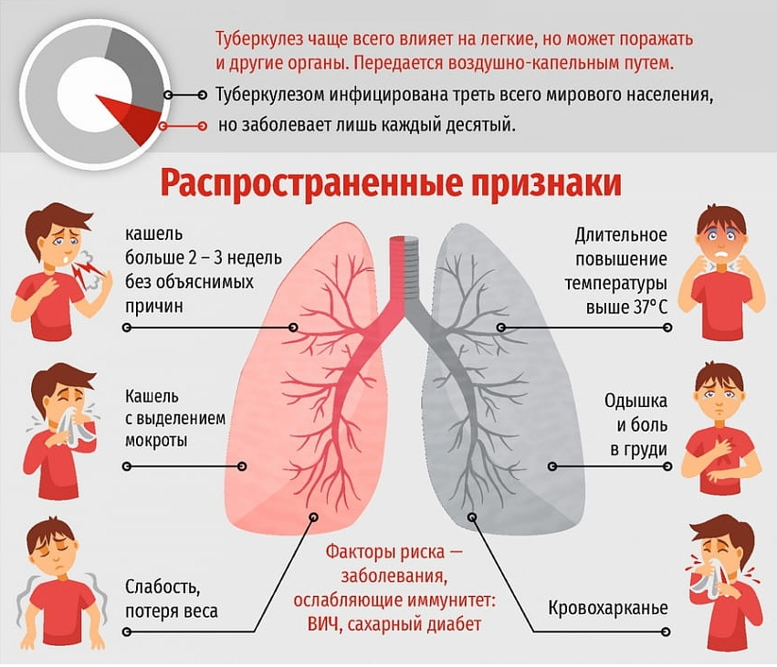 Туберкулез: симптомы, первые признаки у детей - подробная информация