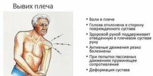 Лфк – незаменимый метод реабилитации при вывихе плечевого сустава: лечение упражнениями