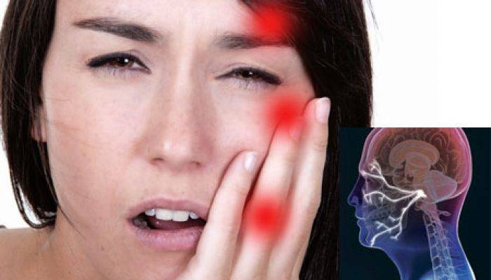 Эффективные советы по лечению лицевого нерва (неврита) дома