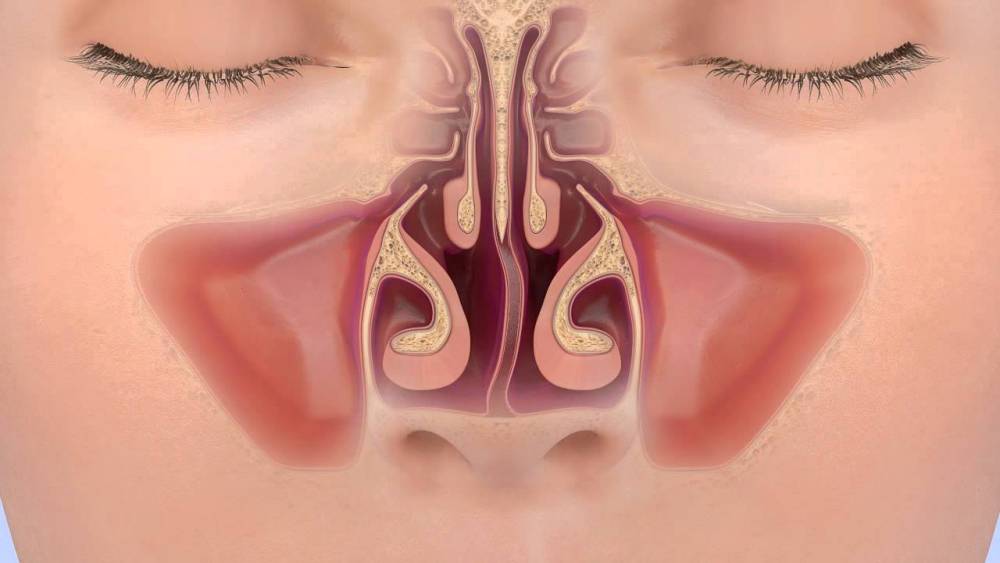 Искривление носовой перегородки (мкб 10): возникновение и лечение