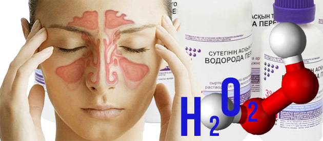 Перекись водорода при гайморите: верное лечение