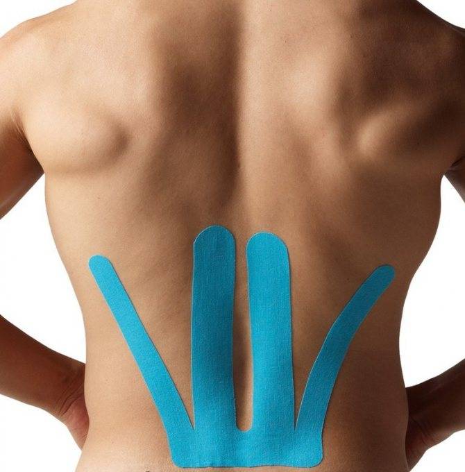 Как правильно накладывать тейпы на грудной, шейный и позвоночный отдел спины