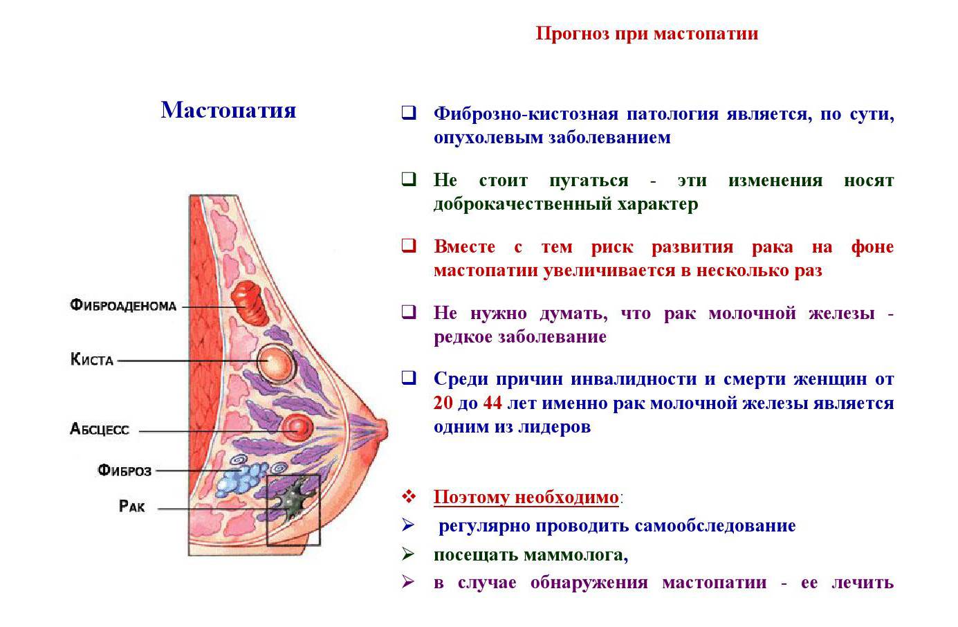 Чем опасна фиброзно-кистозная мастопатия молочных желез + симптомы и лечение | lisa.ru
