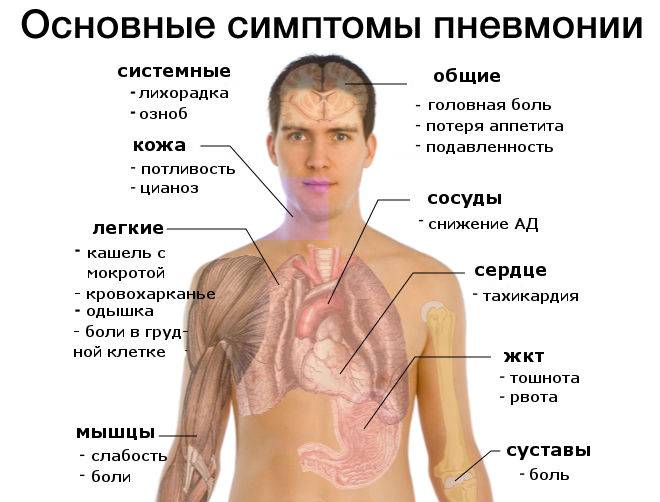 Пневмония без кашля: причины, симптомы, лечение