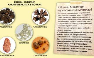 Диеты при оксалатных камнях в почках: лечебное питание и питьевой режим, особенности меню для женщин и мужчин