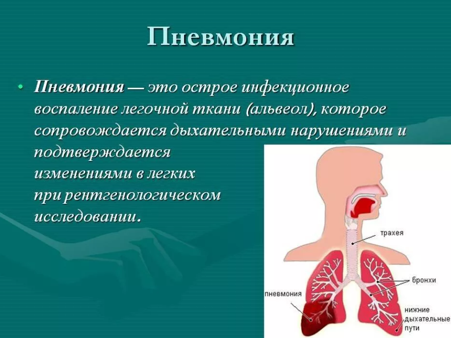 Воспаление лёгких у детей без температуры