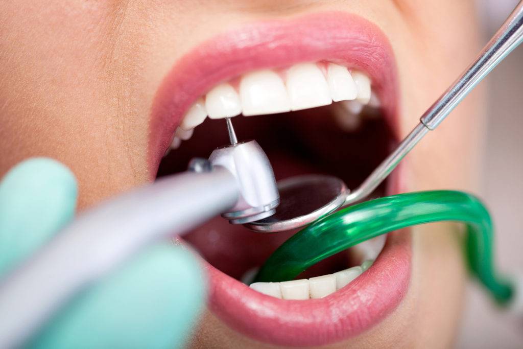 Депульпирование зуба: что это такое, что значит, сколько прослужит, последствия операции