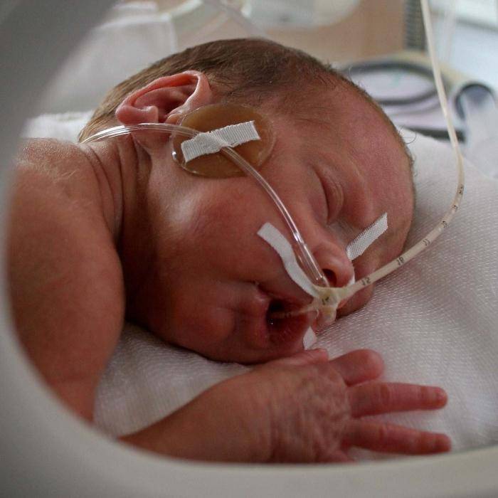Врожденная пневмония у новорожденных: причины и последствия