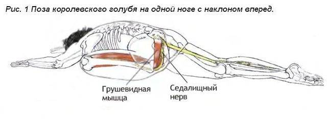 Синдром грушевидной мышцы лечение в домашних условиях | dlja-pohudenija.ru