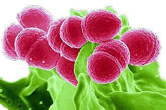 Вирусная или бактериальная ангина: в чем отличие?