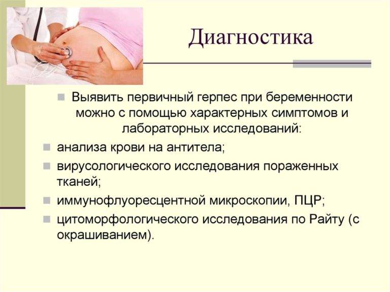 Фарингит при беременности