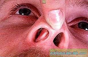Болячки в носу: причины появления, способы эффективного лечения