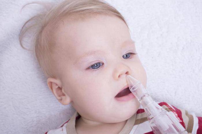 Если сопли у ребёнка 4 месяца, чем лечить: эффективные мероприятия по лечению недуга